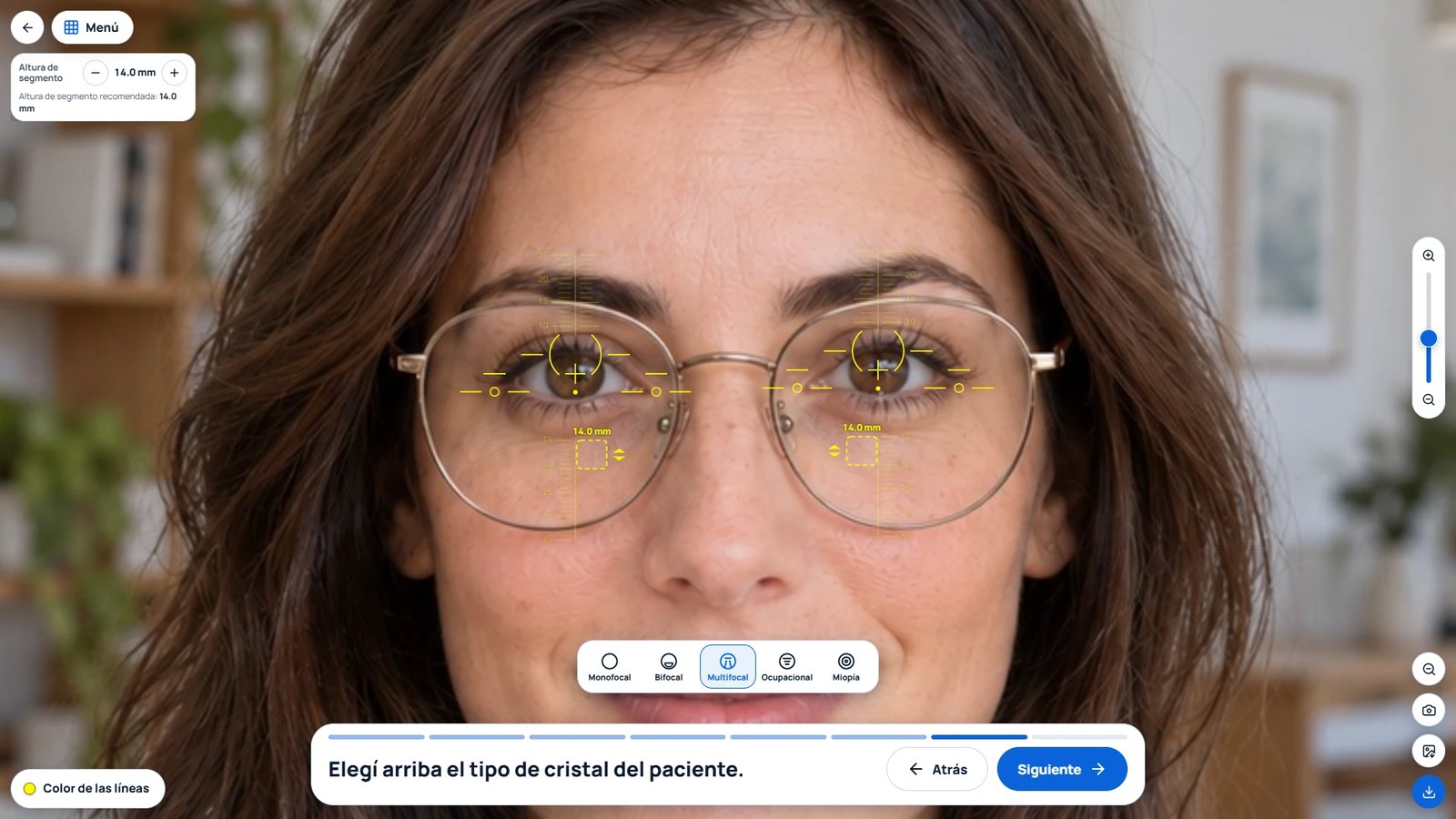 Herramienta Medidas sobre la foto de frente de una paciente con anteojos: pupilas, zona de cerca marcada y selector de tipo de cristal con la altura de segmento